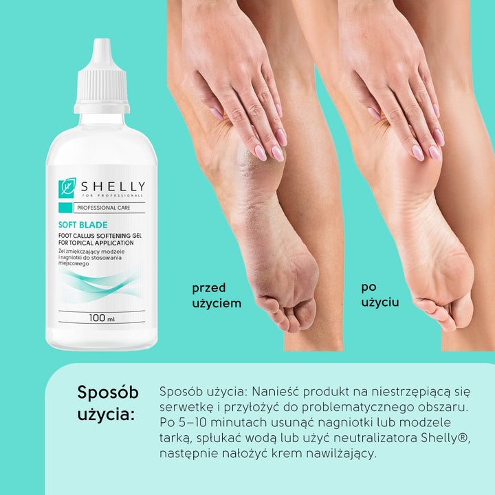 Foot Callus Softening Gel For Topical Application Soft blade Shelly 100 ml