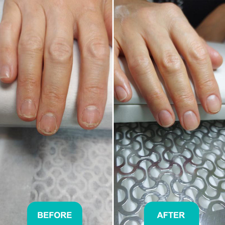 Oil for damaged nail plate - 30 ml